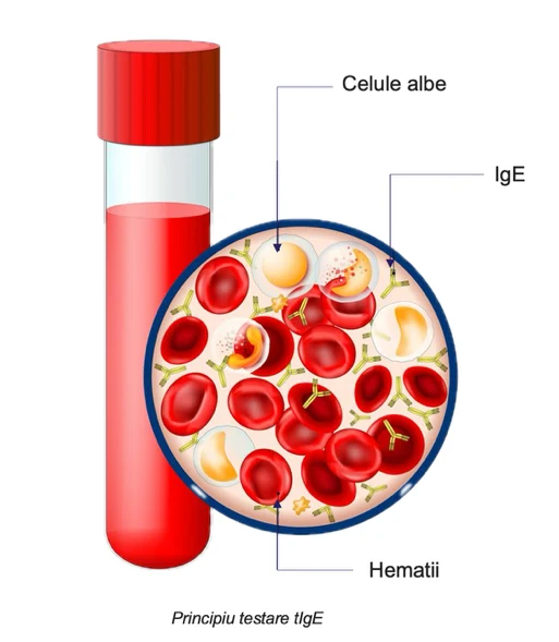 Comparatie intre Phadiatop si Phadiatop Infant, cu alergenii inclusi in fiecare test